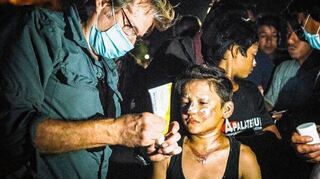Der Mainzer Arzt Gerhard Trabert behandelt die Brandwunden von geflüchteten Kindern auf der grieschichen Insel Lesbos.