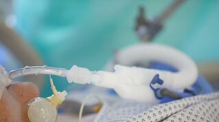 Vier Covid-19-Patienten werden derzeit im Caritas Krankenhaus Bad Mergentheim beatmet. Die Ärztlichen Direktoren an debn Kliniken in der Kur- und in der Kreisstadt sehen die vierte Welle mit voller Wucht auf sich zurollen und befürchten, terminierte Eingriffe bald absagen zu müssen.
