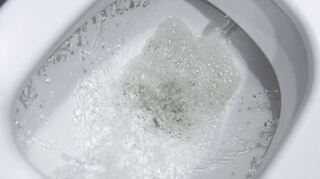 Täglich betätigt man die Toilettenspülung – ohne daran zu denken, was mit dem Abwasser geschieht. Für die Entsorgung müssen die Hardheimer nun mehr zahlen.