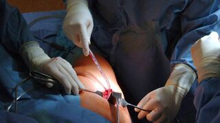In Deutschland werden immer mehr künstliche Knie-und Hüftgelenke eingesetzt. Die AOK testete nun, welche Kliniken dafür am besten geeignet sind.